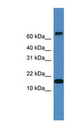 CST9 Antibody - CST9 antibody Western blot of Fetal Heart lysate. This image was taken for the unconjugated form of this product. Other forms have not been tested.