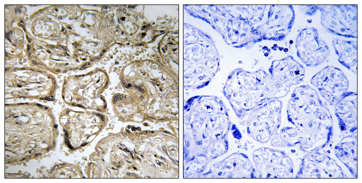 CST9L / Cystatin 9-Like Antibody - Immunohistochemistry analysis of paraffin-embedded human placenta, using CST9L Antibody. The picture on the right is blocked with the synthesized peptide.