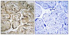 CST9L / Cystatin 9-Like Antibody - Immunohistochemistry analysis of paraffin-embedded human placenta, using CST9L Antibody. The picture on the right is blocked with the synthesized peptide.