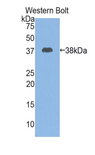 CSTA / Cystatin A Antibody - Western blot of recombinant CSTA / Cystatin A.  This image was taken for the unconjugated form of this product. Other forms have not been tested.