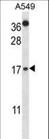 CSTA / Cystatin A Antibody - CSTA Antibody western blot of A549 cell line lysates (35 ug/lane). The CSTA antibody detected the CSTA protein (arrow).