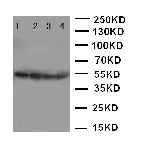 CSTA / Cystatin A Antibody - WB of CSTA / Cystatin A antibody. Recombinant Protein Detection Source:. E.coli derived -recombinant Human CSTA, 45.0KD. (M1-F98+unrelated protein,311aa). . Lane 1: Recombinant Human CSTA Protein 10ng. Lane 2: Recombinant Human CSTA Protein 5ng. Lane 3: Recombinant Human CSTA Protein 2.5ng. Lane 4: Recombinant Human CSTA Protein 1.25ng..