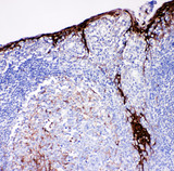 CSTA / Cystatin A Antibody - CSTA / Cystatin A antibody. IHC(P): Human Tonsil Tissue.