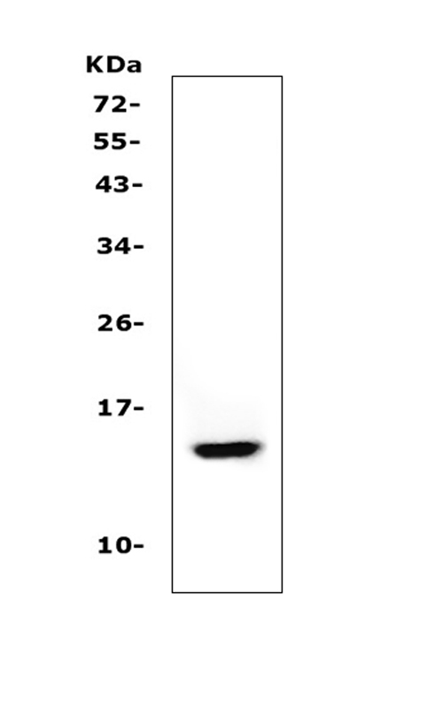 CSTA / Cystatin A Antibody - Western blot analysis of Cystatin A/CSTA using anti-Cystatin A/CSTA antibody. Electrophoresis was performed on a 5-20% SDS-PAGE gel at 70V (Stacking gel) / 90V (Resolving gel) for 2-3 hours. The sample well of each lane was loaded with 50ug of sample under reducing conditions. Lane 1: human A431 whole cell lysates. After Electrophoresis, proteins were transferred to a Nitrocellulose membrane at 150mA for 50-90 minutes. Blocked the membrane with 5% Non-fat Milk/ TBS for 1.5 hour at RT. The membrane was incubated with rabbit anti-Cystatin A/CSTA antigen affinity purified polyclonal antibody at 0.5 µg/mL overnight at 4°C, then washed with TBS-0.1% Tween 3 times with 5 minutes each and probed with a goat anti-rabbit IgG-HRP secondary antibody at a dilution of 1:10000 for 1.5 hour at RT. The signal is developed using an Enhanced Chemiluminescent detection (ECL) kit with Tanon 5200 system. A specific band was detected for Cystatin A/CSTA at approximately 14KD. The expected band size for Cystatin A/CSTA is at 11KD.