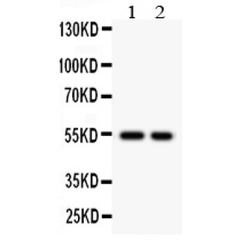 CSTA / Cystatin A Antibody - Cystatin A antibody Western blot. All lanes: Anti Cystatin A at 0.5 ug/ml. Lane 1: HELA Whole Cell Lysate at 40 ug. Lane 2: SMMC Whole Cell Lysate at 40 ug. Predicted band size: 54 kD. Observed band size: 54 kD.