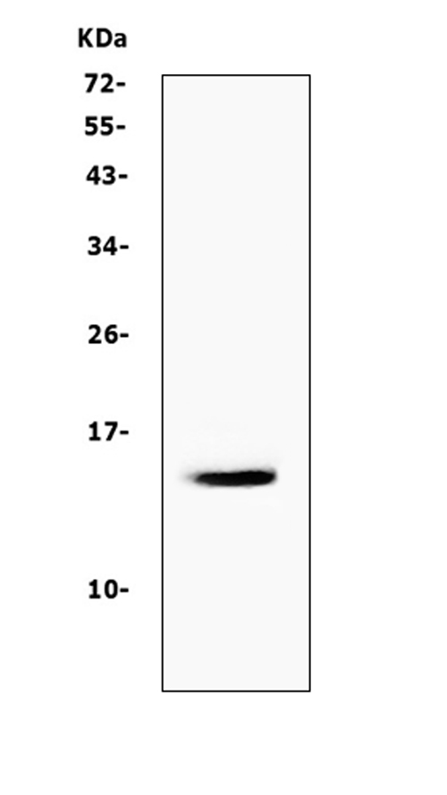 CSTA / Cystatin A Antibody - Western blot analysis of Cystatin A/CSTA using anti-Cystatin A/CSTA antibody. Electrophoresis was performed on a 5-20% SDS-PAGE gel at 70V (Stacking gel) / 90V (Resolving gel) for 2-3 hours. The sample well of each lane was loaded with 50ug of sample under reducing conditions. Lane 1: human K562 whole cell lysates. After Electrophoresis, proteins were transferred to a Nitrocellulose membrane at 150mA for 50-90 minutes. Blocked the membrane with 5% Non-fat Milk/ TBS for 1.5 hour at RT. The membrane was incubated with rabbit anti-Cystatin A/CSTA antigen affinity purified polyclonal antibody at 0.5 µg/mL overnight at 4°C, then washed with TBS-0.1% Tween 3 times with 5 minutes each and probed with a goat anti-rabbit IgG-HRP secondary antibody at a dilution of 1:10000 for 1.5 hour at RT. The signal is developed using an Enhanced Chemiluminescent detection (ECL) kit with Tanon 5200 system. A specific band was detected for Cystatin A/CSTA at approximately 14KD. The expected band size for Cystatin A/CSTA is at 11KD.