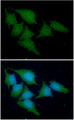 CSTA / Cystatin A Antibody - ICC/IF analysis of CSTA in HeLa cells line, stained with DAPI (Blue) for nucleus staining and monoclonal anti-human CSTA antibody (1:100) with goat anti-mouse IgG-Alexa fluor 488 conjugate (Green).