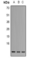 CSTA / Cystatin A Antibody - Western blot analysis of Cystatin A expression in K562 (A); HT29 (B); A549 (C) whole cell lysates.