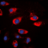 CSTA / Cystatin A Antibody - Immunofluorescent analysis of Cystatin A staining in A549 cells. Formalin-fixed cells were permeabilized with 0.1% Triton X-100 in TBS for 5-10 minutes and blocked with 3% BSA-PBS for 30 minutes at room temperature. Cells were probed with the primary antibody in 3% BSA-PBS and incubated overnight at 4 deg C in a humidified chamber. Cells were washed with PBST and incubated with a DyLight 594-conjugated secondary antibody (red) in PBS at room temperature in the dark. DAPI was used to stain the cell nuclei (blue).
