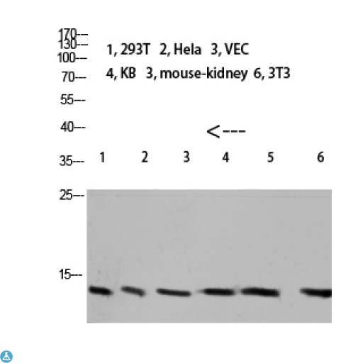 CSTA / Cystatin A Antibody - Western blot analysis of 293T, HeLa, VEC, KB, mouse kidney, 3T3 lysate, antibody was diluted at 1000. Secondary antibody was diluted at 1:20000.