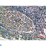 CSTA / Cystatin A Antibody - Immunohistochemical analysis of paraffin-embedded human-tonsil, antibody was diluted at 1:200.