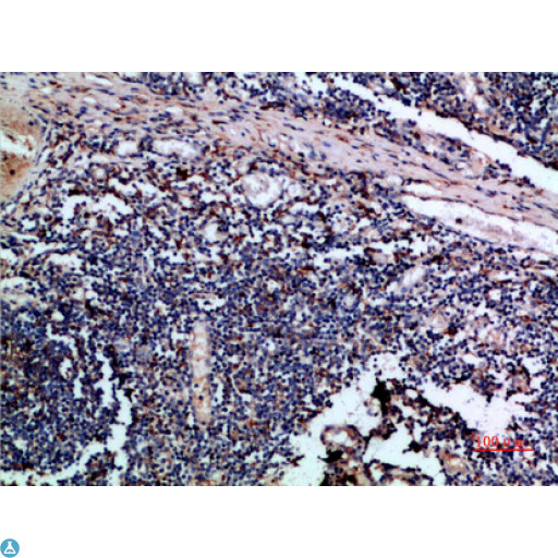CSTA / Cystatin A Antibody - Immunohistochemical analysis of paraffin-embedded human-tonsil, antibody was diluted at 1:200.