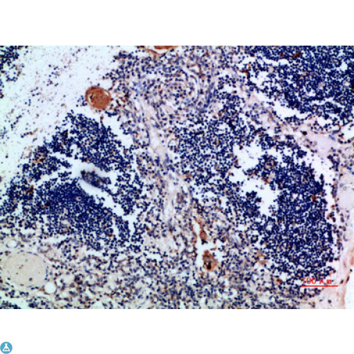 CSTA / Cystatin A Antibody - Immunohistochemical analysis of paraffin-embedded human-thymus, antibody was diluted at 1:200.