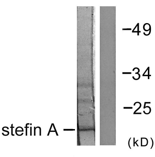 CSTA / Cystatin A Antibody - Western blot analysis of extracts from A549 cells, using Stefin A antibody.