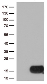 CSTB / Cystatin B / Stefin B Antibody - HEK293T cells were transfected with the pCMV6-ENTRY control. (Left lane) or pCMV6-ENTRY CSTB. (Right lane) cDNA for 48 hrs and lysed. Equivalent amounts of cell lysates. (5 ug per lane) were separated by SDS-PAGE and immunoblotted with anti-CSTB. (1:500)