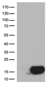 CSTB / Cystatin B / Stefin B Antibody - HEK293T cells were transfected with the pCMV6-ENTRY control. (Left lane) or pCMV6-ENTRY CSTB. (Right lane) cDNA for 48 hrs and lysed. Equivalent amounts of cell lysates. (5 ug per lane) were separated by SDS-PAGE and immunoblotted with anti-CSTB. (1:500)
