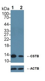 CSTB / Cystatin B / Stefin B Antibody - Knockout Varification: Lane 1: Wild-type HepG2 cell lysate; Lane 2: CSTB knockout HepG2 cell lysate; Predicted MW: 11kDa Observed MW: 14kDa Primary Ab: 2µg/ml Rabbit Anti-Human CSTB Antibody Second Ab: 0.2µg/mL HRP-Linked Caprine Anti-Rabbit IgG Polyclonal Antibody