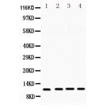 CSTB / Cystatin B / Stefin B Antibody - Stefin B antibody Western blot. All lanes: Anti Stefin B at 0.5 ug/ml. Lane 1: Human Placenta Tissue Lysate at 50 ug. Lane 2: HELA Whole Cell Lysate at 40 ug. Lane 3: A431 Whole Cell Lysate at 40 ug. Lane 4: A549 Whole Cell Lysate at 40 ug. Predicted band size: 11 kD. Observed band size: 11 kD.