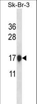 CSTB / Cystatin B / Stefin B Antibody - CSTB Antibody western blot of SK-BR-3 cell line lysates (35 ug/lane). The CSTB antibody detected the CSTB protein (arrow).