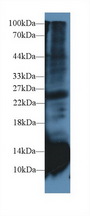 CSTB / Cystatin B / Stefin B Antibody