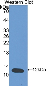 CSTB / Cystatin B / Stefin B Antibody