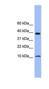 CSTB / Cystatin B / Stefin B Antibody - CSTB / Stefin B antibody Western blot of Fetal Heart lysate. This image was taken for the unconjugated form of this product. Other forms have not been tested.