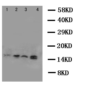 CSTB / Cystatin B / Stefin B Antibody - WB of CSTB / Cystatin B / Stefin B antibody. Lane 1: A549 Cell Lysate. Lane 2: A431 Cell Lysate. Lane 3: COLO320 Cell Lysate. Lane 4: HELA Cell Lysate.