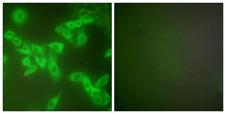 CSTB / Cystatin B / Stefin B Antibody - Immunofluorescence analysis of A549 cells, using Stefin B Antibody. The picture on the right is blocked with the synthesized peptide.
