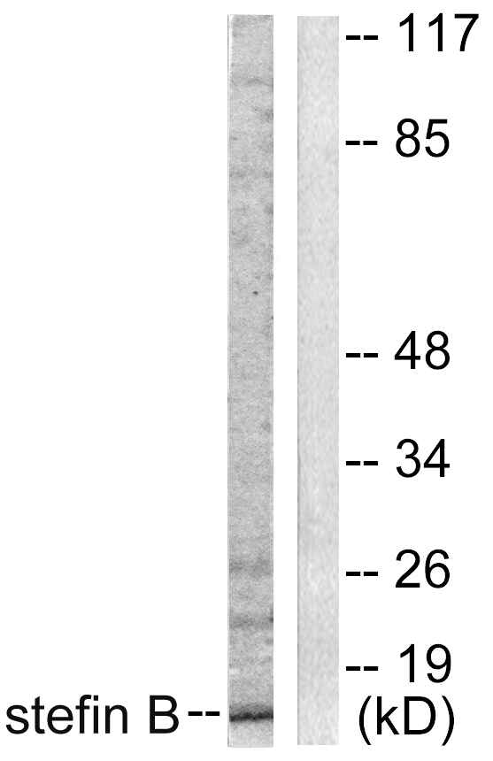 CSTB / Cystatin B / Stefin B Antibody - Western blot analysis of lysates from A549 cells, using Stefin B Antibody. The lane on the right is blocked with the synthesized peptide.