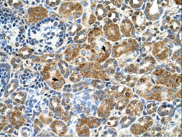 CSTB / Cystatin B / Stefin B Antibody - CSTB / Stefin B antibody CSTB(cystatin B (stefin B)) Antibody was used in IHC to stain formalin-fixed, paraffin-embedded human kidney.  This image was taken for the unconjugated form of this product. Other forms have not been tested.