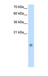 CSTB / Cystatin B / Stefin B Antibody - Transfected 293T cell lysate. Antibody concentration: 0.25 ug/ml. Gel concentration: 15%.  This image was taken for the unconjugated form of this product. Other forms have not been tested.