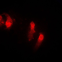 CSTB / Cystatin B / Stefin B Antibody - Immunofluorescent analysis of Cystatin B staining in EOC20 cells. Formalin-fixed cells were permeabilized with 0.1% Triton X-100 in TBS for 5-10 minutes and blocked with 3% BSA-PBS for 30 minutes at room temperature. Cells were probed with the primary antibody in 3% BSA-PBS and incubated overnight at 4 C in a humidified chamber. Cells were washed with PBST and incubated with a DyLight 594-conjugated secondary antibody (red) in PBS at room temperature in the dark. DAPI was used to stain the cell nuclei (blue).