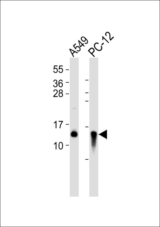 CSTB / Cystatin B / Stefin B Antibody - All lanes : Anti-Cystatin B Antibody at 1:1000 dilution Lane 1: A549 whole cell lysates Lane 2: PC-12 whole cell lysates Lysates/proteins at 20 ug per lane. Secondary Goat Anti-Rabbit IgG, (H+L),Peroxidase conjugated at 1/10000 dilution Predicted band size : 11 kDa Blocking/Dilution buffer: 5% NFDM/TBST.