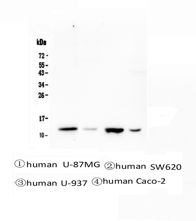 CSTB / Cystatin B / Stefin B Antibody - Western blot analysis of Stefin B using anti-Stefin B antibody. Electrophoresis was performed on a 5-20% SDS-PAGE gel at 70V (Stacking gel) / 90V (Resolving gel) for 2-3 hours. The sample well of each lane was loaded with 50ug of sample under reducing conditions. Lane 1: human U-87MG whole cell lysates, Lane 2: human SW620 whole cell lysates, Lane 3: human U-937 whole cell lysates, Lane 4: human Caco-2 whole cell lysates. After Electrophoresis, proteins were transferred to a Nitrocellulose membrane at 150mA for 50-90 minutes. Blocked the membrane with 5% Non-fat Milk/ TBS for 1.5 hour at RT. The membrane was incubated with mouse anti-Stefin B antigen affinity purified monoclonal antibody at 0.5 µg/mL overnight at 4°C, then washed with TBS-0.1% Tween 3 times with 5 minutes each and probed with a Biotin Conjugated goat anti-mouse IgG secondary antibody at a dilution of 1:10000 for 1.5 hour at RT. The signal is developed using an Enhanced Chemiluminescent detection (ECL) kit with Tanon 5200 system.