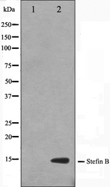 CSTB / Cystatin B / Stefin B Antibody - Western blot analysis on A549 cell lysates using CSTB antibody. The lane on the left is treated with the antigen-specific peptide.