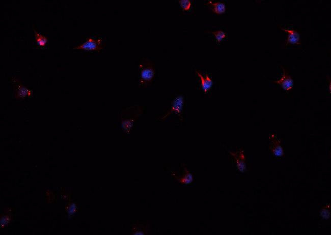CSTB / Cystatin B / Stefin B Antibody - Staining A549 cells by IF/ICC. The samples were fixed with PFA and permeabilized in 0.1% Triton X-100, then blocked in 10% serum for 45 min at 25°C. The primary antibody was diluted at 1:200 and incubated with the sample for 1 hour at 37°C. An Alexa Fluor 594 conjugated goat anti-rabbit IgG (H+L) Ab, diluted at 1/600, was used as the secondary antibody.