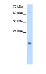 CSTB / Cystatin B / Stefin B Antibody - Transfected 293T cell lysate. Antibody concentration: 0.25 ug/ml. Gel concentration: 15%.  This image was taken for the unconjugated form of this product. Other forms have not been tested.