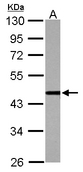 CSTF1 Antibody - Sample (30 ug of whole cell lysate) A: Jurkat 10% SDS PAGE CSTF1 antibody diluted at 1:1000