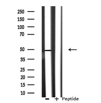 CSTF1 Antibody - Western blot analysis of extracts of 293 cells using CSTF1 antibody.