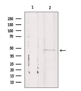CSTF1 Antibody - Western blot analysis of extracts of mouse carcinoma using CSTF1 antibody. Lane 1 was treated with the blocking peptide.