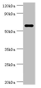 CSTF2 / CstF-64 Antibody - Western blot All lanes: CSTF2 antibody at 6µg/ml + Jurkat whole cell lysate Secondary Goat polyclonal to rabbit IgG at 1/10000 dilution Predicted band size: 61, 60 kDa Observed band size: 61 kDa
