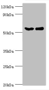 CSTF2 / CstF-64 Antibody - Western blot All lanes: CSTF2 antibody at 6µg/ml Lane 1: Hela whole cell lysate Lane 2: Jurkat whole cell lysate Secondary Goat polyclonal to rabbit IgG at 1/10000 dilution Predicted band size: 61, 60 kDa Observed band size: 61 kDa