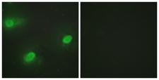 CSTF2 / CstF-64 Antibody - Immunofluorescence analysis of HeLa cells, using CSTF2 Antibody. The picture on the right is blocked with the synthesized peptide.