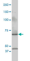 CSTF2 / CstF-64 Antibody - CSTF2 monoclonal antibody (M01), clone 3D1-3A6 Western blot of CSTF2 expression in Jurkat.