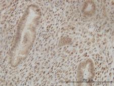 CSTF2 / CstF-64 Antibody - Immunoperoxidase of monoclonal antibody to CSTF2 on formalin-fixed paraffin-embedded human endometrium tissue. [antibody concentration 3 ug/ml].