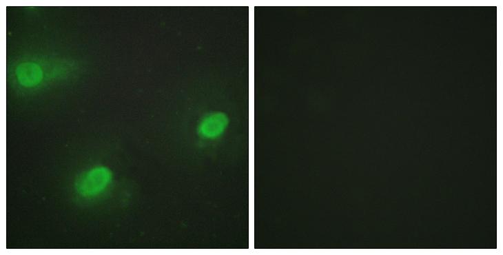 CSTF2 / CstF-64 Antibody - Peptide - + Immunofluorescence analysis of HeLa cells, using CSTF2 antibody.
