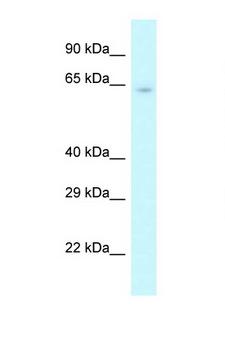 CSTF2 / CstF-64 Antibody - Western blot of Mouse Pancreas lysate. Anti-CSTF2 Antibody concentration 1 ug/ml.  This image was taken for the unconjugated form of this product. Other forms have not been tested.