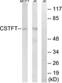 CSTF2T Antibody - Western blot analysis of lysates from Jurkat and MCF-7 cells, using CSTF2T Antibody. The lane on the right is blocked with the synthesized peptide.