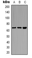 CSTF2T Antibody - Western blot analysis of CstF-64T expression in HeLa (A); PC3 (B); MCF7 (C) whole cell lysates.