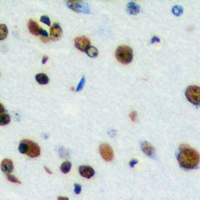 CSTF2T Antibody - Immunohistochemical analysis of CstF-64T staining in human brain formalin fixed paraffin embedded tissue section. The section was pre-treated using heat mediated antigen retrieval with sodium citrate buffer (pH 6.0). The section was then incubated with the antibody at room temperature and detected with HRP and DAB as chromogen. The section was then counterstained with hematoxylin and mounted with DPX.